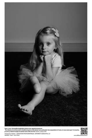 Saori, 3 ans, amputée de la jambe droite pose en tenue de danseuse classique